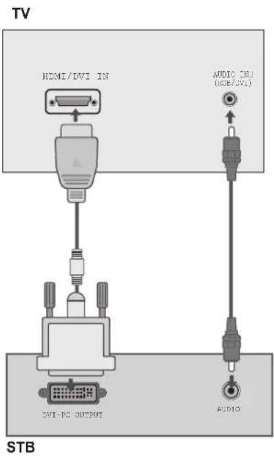 LG 37LG5300 - Tilslutning med et HDMI-til-DVI-kabel - 1