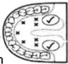 Emerio MT-105867 - ANVISNINGAR - 1