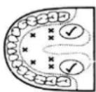 Emerio MT-105867 - VEJLEDNINGER - 1