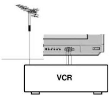 VCR