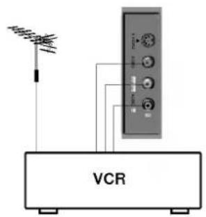 VCR