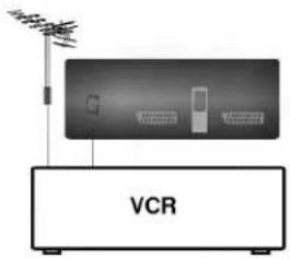 VCR