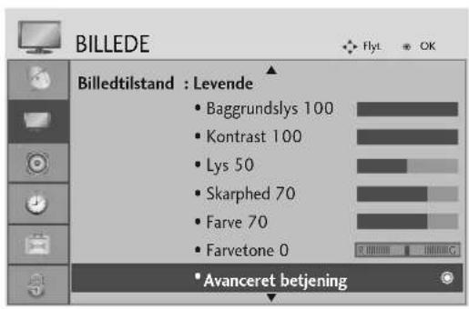 LG 37LG5010 - AVANCERET - SORTNIVEAU - 1