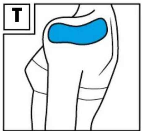 Sensiplast IAN 270380 - CINTAS KINESIOLÓGICAS - 10