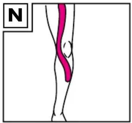 Sensiplast IAN 270380 - CINTAS KINESIOLÓGICAS - 4