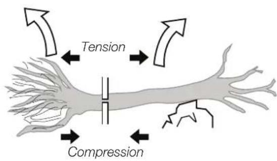 Tension Compression