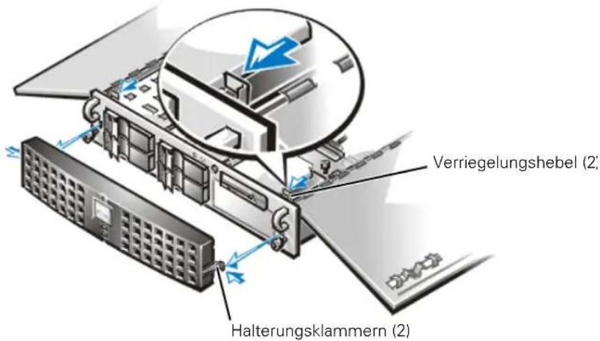 Verriegelungshebel (2) Halterungsklammern (2)