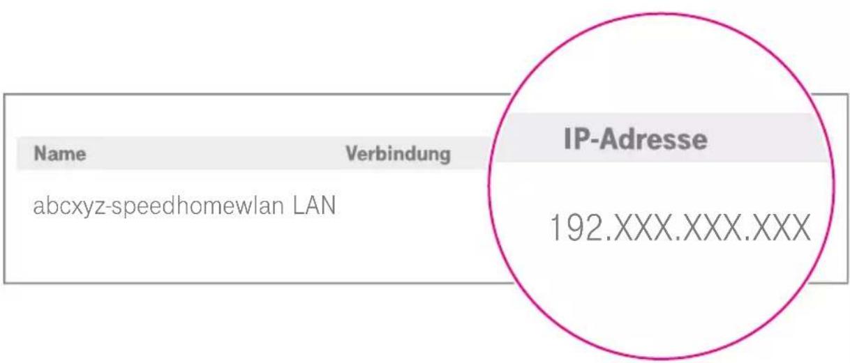 Name Verbindung abcxyz-speedhomewlan LAN IP-Adresse 192.XXX.XXX.XXX