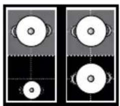 Two identical panels showing circular objects with internal patterns, no text or symbols present