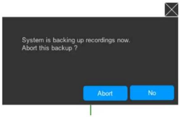 System is backing up recordings now. Abort this backup ? Abort No