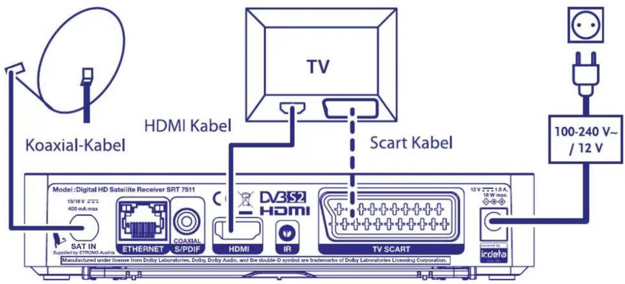 STRONG SRT 7511 - Verbindung mittels HDMI oder SCART Kabel - 1