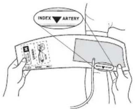 OMRON HBP-1300 - Richten Sie die Markierung „INDEX ARTERY“ auf die Arteria brachialis aus. - 1
