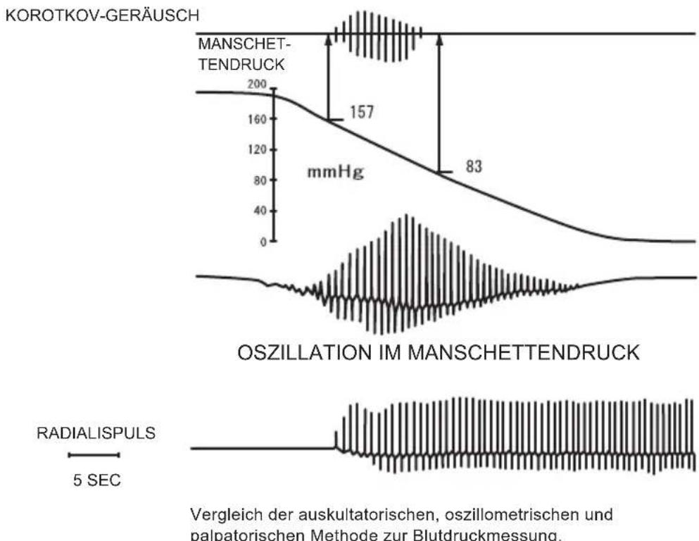 OMRON HBP-1300 - Oszillometrische Methode - 1