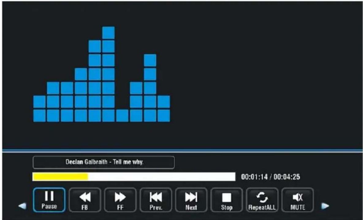 MBM NEMESIS SOUND 3.2 HD - MUSIK - 1
