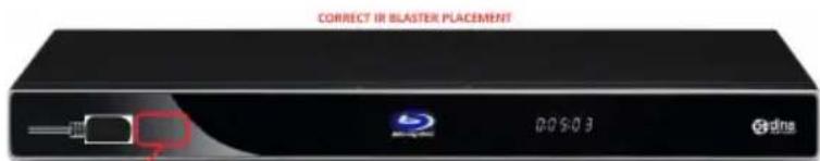 CORRECT IR BLASTER PLACEMENT 00:03