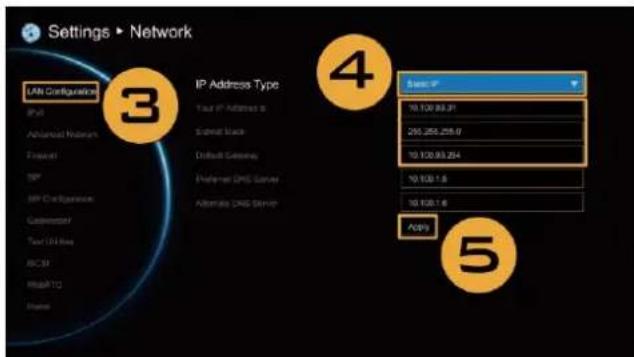 Settings ▶ Network LAN Configurations IP Advanced Material Financial SIP SIP Chain Copyright Tour 100 Bits BCCM Risik TC Programs IP Address Type Your IP Address is Submit Stack Default Gateway Preferred DNS Server Alternate DNS Server Siaser IP 10.120.93.31 250.250.258.9 10.120.93.254 10.130.1.5 10.130.1.6 ACKS 4 5