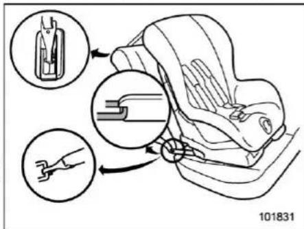 Medical illustration showing a catheter insertion procedure with magnified views of the catheter and device placement.