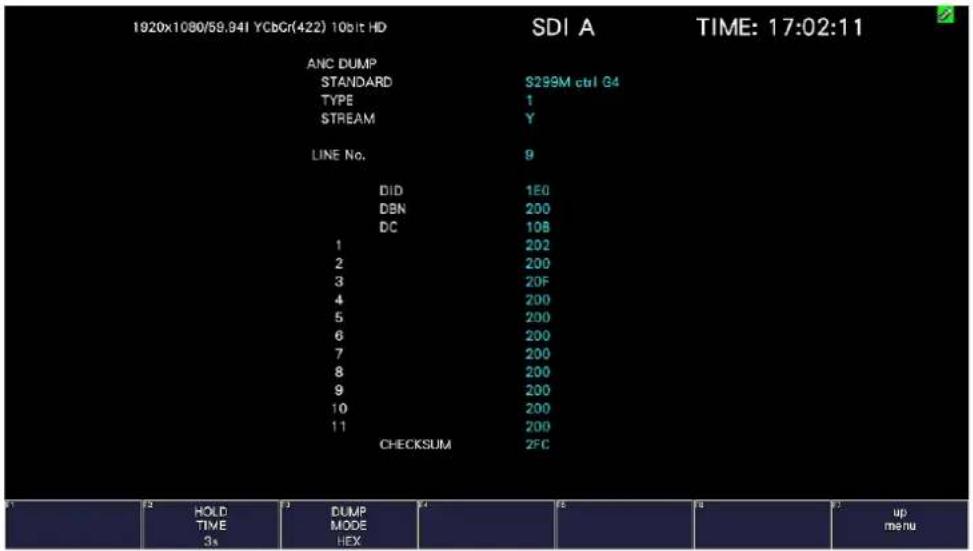 1920x1080/59.94I YCbCr(422) 10bit HD SDI A TIME: 17:02:11 ANC DUMP STANDARD S299M ctrl G4 TYPE 1 STREAM Y LINE No. 9 DID 1E0 DBN 200 DC 108 1 202 2 200 3 20F 4 200 5 200 6 200 7 200 8 200 9 200 10 200 11 200 CHECKSUM 2FC HOLD TIME 3s DUMP MODE HEX up menu