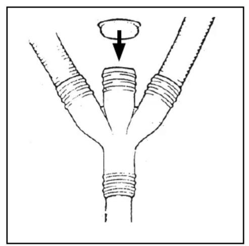 Diagram of a Y-shaped pipe fitting with a circular component above it, showing braided ends and a downward arrow (no text or symbols)