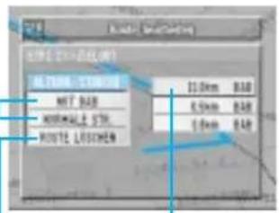 MUT RAD NORMAL STR ROUTE LUXEM 10.0mm 840 6.5mm 840 7.5mm 840