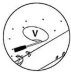 V