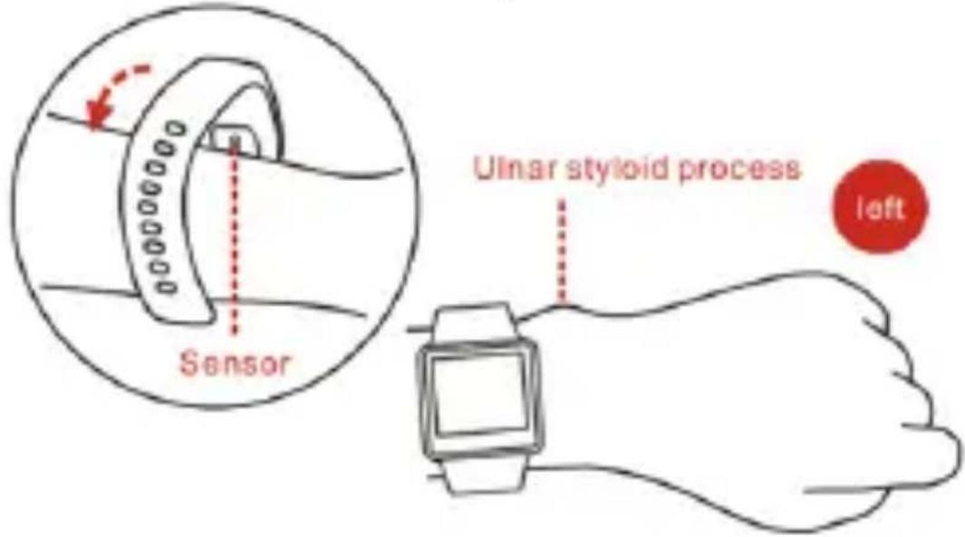Sensor Ulnar styloid process left