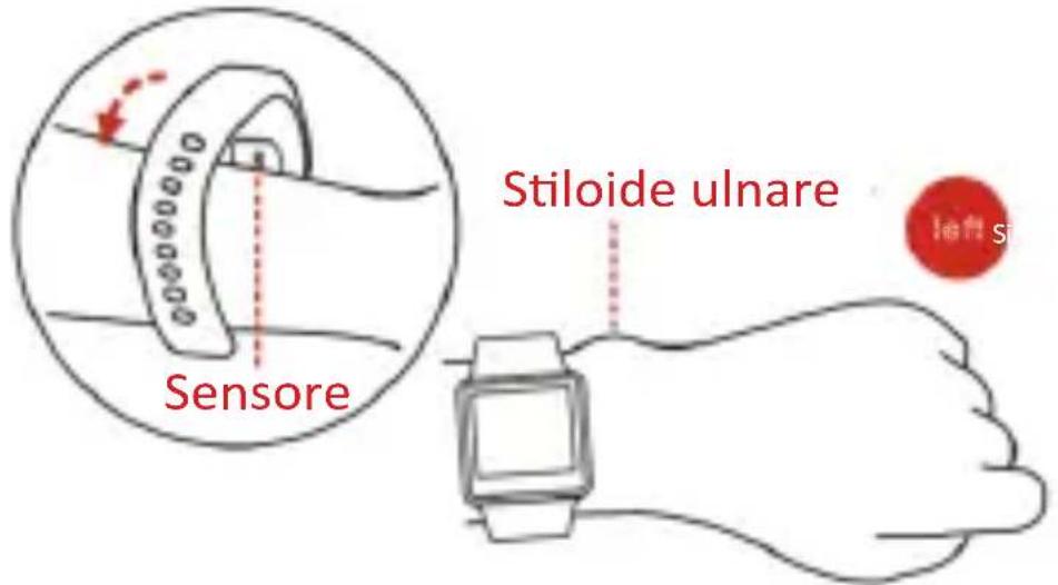 Sensore Stiloide ulnare