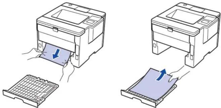 BROTHER HL-L6400DWTT - Papierstau in der Kassette für beidseitigen Druck - 3