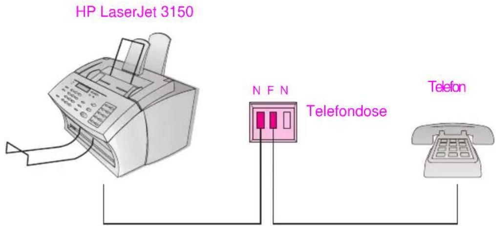 HP LaserJet 3150 N F N Telefondose Telefon