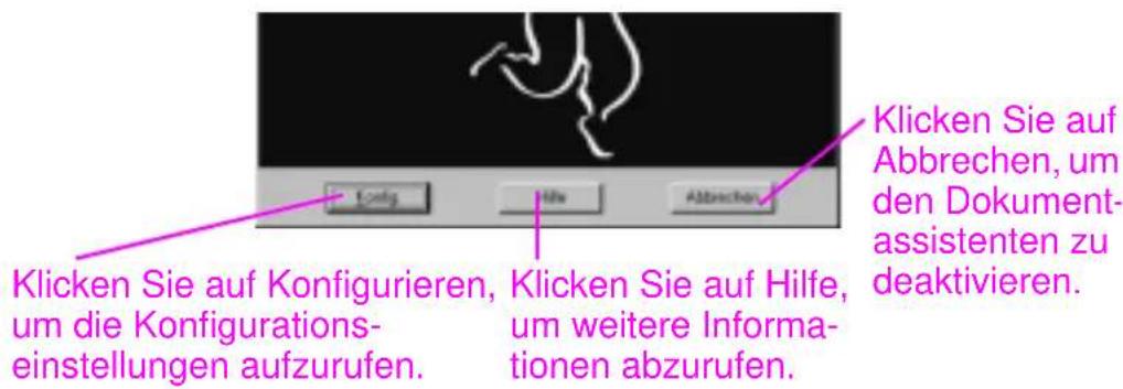 Klicken Sie auf Konfigurieren, um die Konfigurations- einstellungen aufzurufen. Klicken Sie auf Hilfe, um weitere Informa- tionen abzurufen. Klicken Sie auf Abbrechen, um den Dokument- assistenten zu deaktivieren.