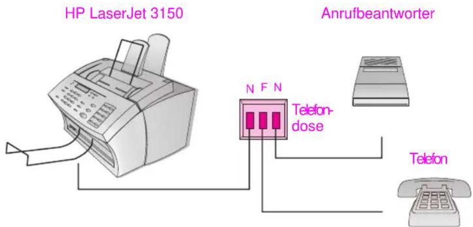 HP LaserJet 3150 Anrufbeantworter N F N Telefon- dose Telefon
