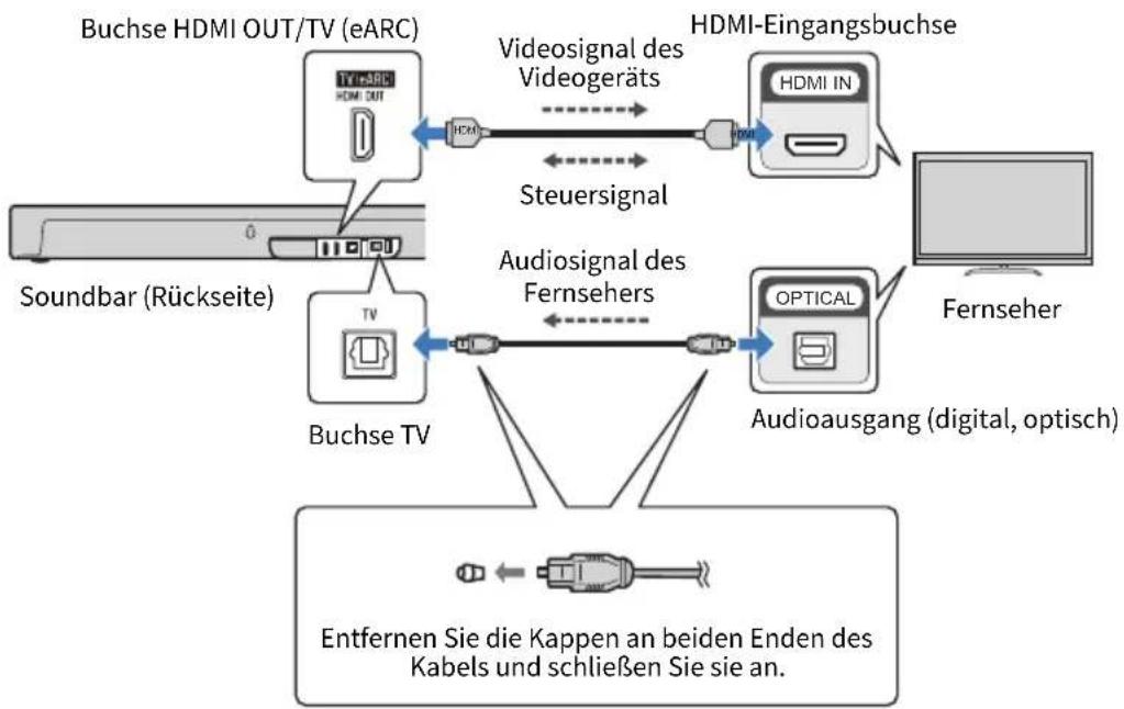 YAMAHA SR-X40A - Bei Anschluss an eine nicht mit ARC kompatible HDMI-Eingangsbuchse - 1