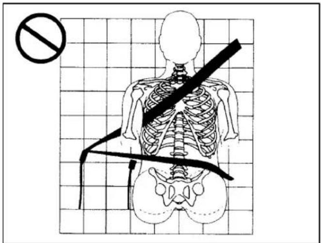 Diagram illustrating a human skeleton with a diagonal band crossing, accompanied by a no-smoking symbol.