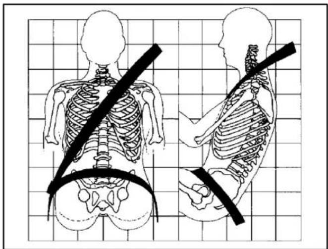 Illustration of human skeletal anatomy showing front and side views with a black band indicating the shoulder (no text or labels)