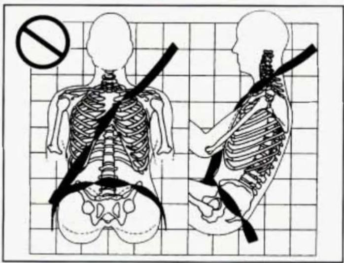 Medical illustration showing human skeletal anatomy with a no-smoking symbol and corresponding side views of the torso.