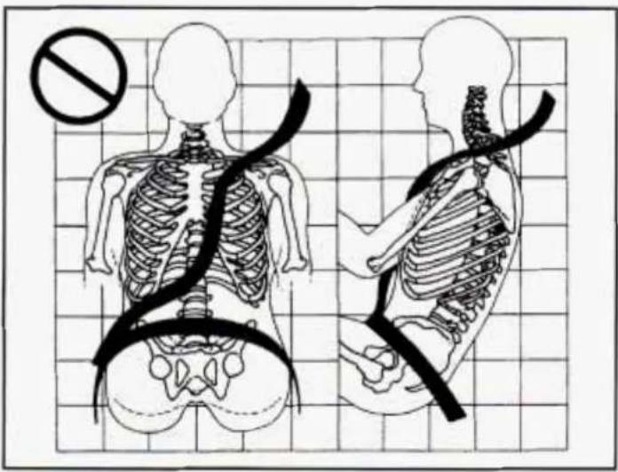Medical diagram showing human skeletal anatomy with a no-smoking symbol and corresponding side views of the spine and torso.