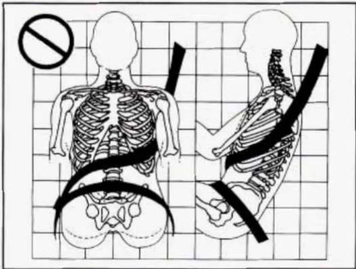 Medical diagram showing human skeletal anatomy with a no-smoking symbol and corresponding side views of the spine and shoulder.