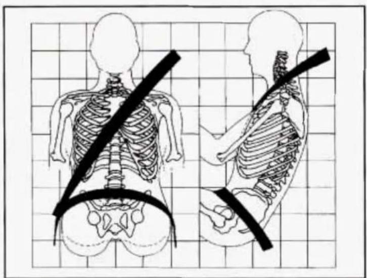 Illustration of human torso and pelvis with a black band indicating shoulder placement (no text or labels)