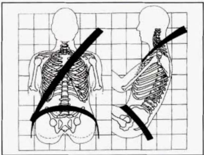 Medical illustration showing human skeletal anatomy with a belt and spine, labeled in English.