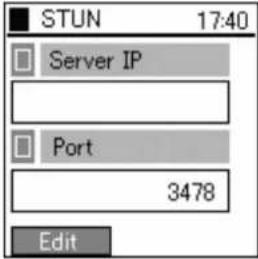 HITACHI IP5000 - NAT Traversal - 5