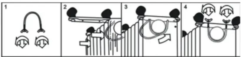 Diagram illustrating four stages of hairpin insertion, showing progressive positioning and disassembly with labeled parts.