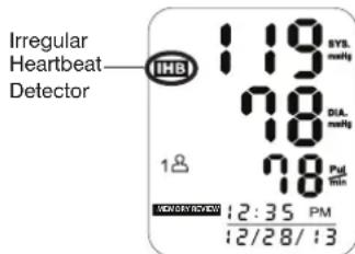 Irregular Heartbeat— Detector 119 SYS. maltg 70 DIA. maltg 70 Pul min 12:35 PM 12/28/13