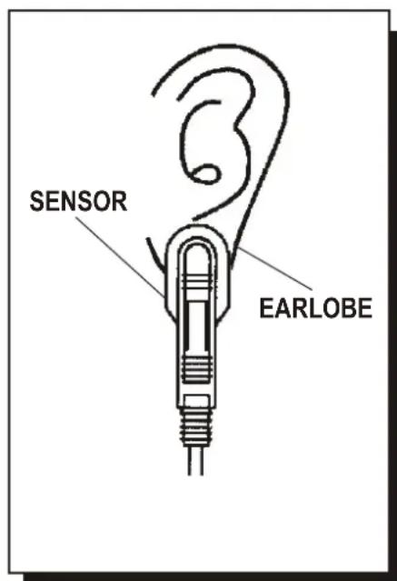 SENSOR EARLOBE
