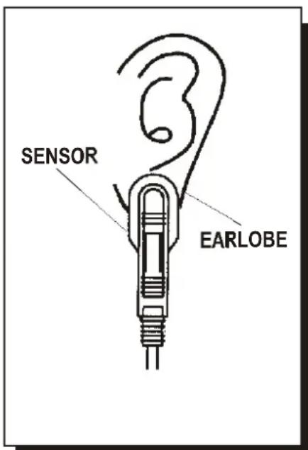 SENSOR EARLOBE