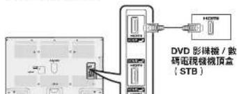 DVD 影像機 / 數 碼電視機器頂盒 (STB)