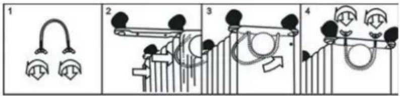 Diagram illustrating four stages of a medical procedure involving ear and shoulder movements, labeled 1 to 4.