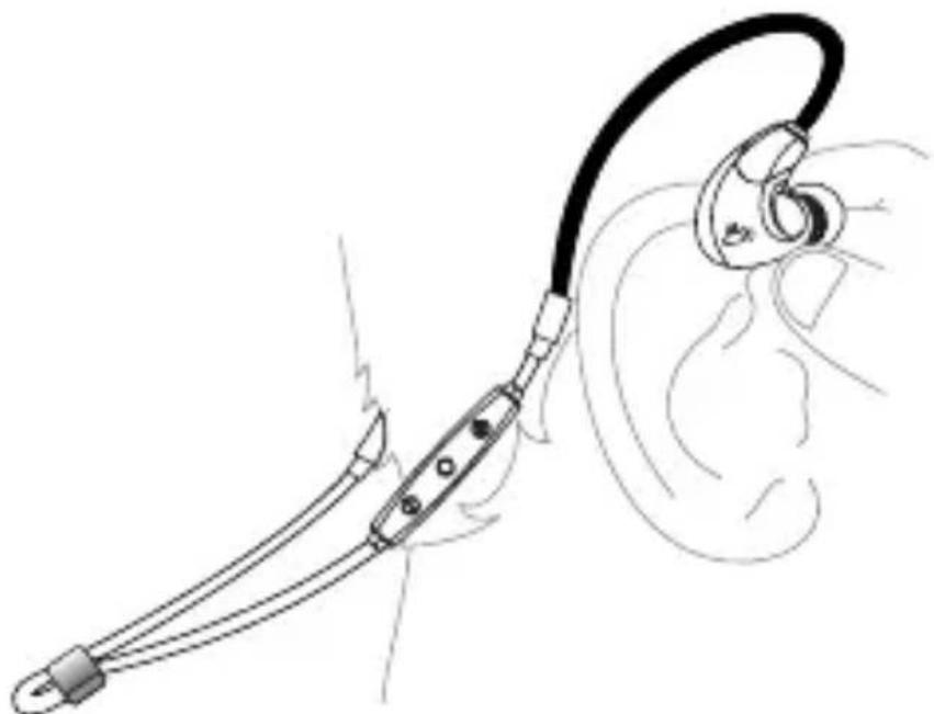 Line drawing of a medical device with ear and ear components, no text or symbols present
