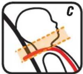GRACO Sequel 65 - Cannot Pinch Harness Straps at the Shoulder (E) - 3