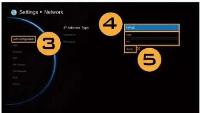 Settings ▶ Network IF Address Type Username Purchased 3 LAN Configuration TYPE User ... Aids 4 5
