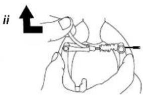 ii